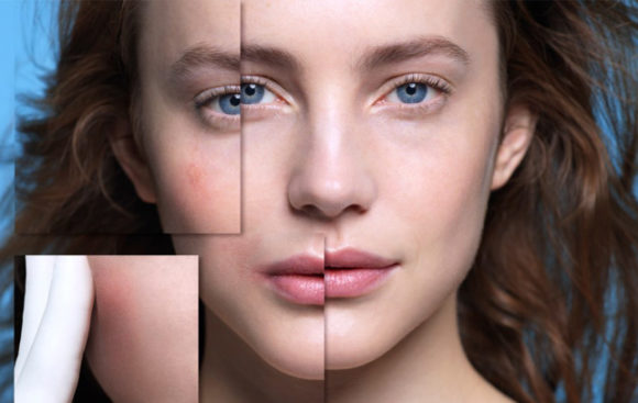 NOVIDADE: Dermallergo, o sérum para pele sensível e reativa da La Roche Posay NOVIDADE: Dermallergo, o sérum para pele sensível e reativa da La Roche Posay