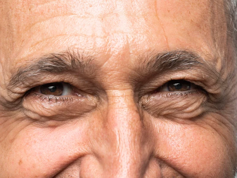 close up de uma pessoa mais envelhecida com olhos com rugas e olheiras